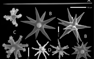 Skeletnaaldjes onder elektronen microscoop